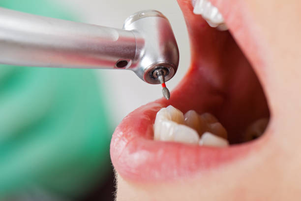 Best Tooth Pain Emergency Relief  in Darrington, WA